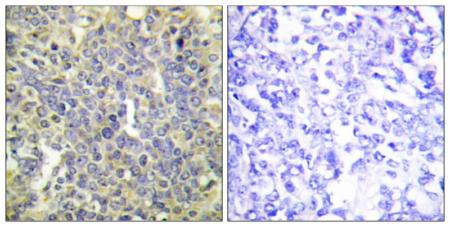 Immunohistochemistry (Formalin/PFA-fixed paraffin-embedded sections) - Anti-Caspase-9 (phospho T125) antibody (AB192815)