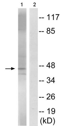 Western blot - Anti-Caspase-9 (phospho T125) antibody (AB192815)