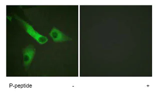 Immunocytochemistry/ Immunofluorescence - Anti-Caspase-9 (phospho Y153) antibody (AB79202)