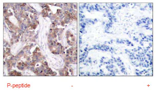Immunohistochemistry (Formalin/PFA-fixed paraffin-embedded sections) - Anti-Caspase-9 (phospho Y153) antibody (AB79202)
