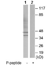 Western blot - Anti-Caspase-9 (phospho Y153) antibody (AB79202)