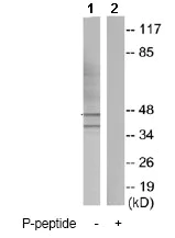 Western blot - Anti-Caspase-9 (phospho Y153) antibody (AB79202)
