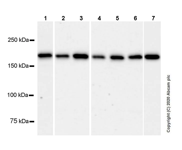Western blot - Anti-Caspr antibody [EPR23439-48] (AB246501)