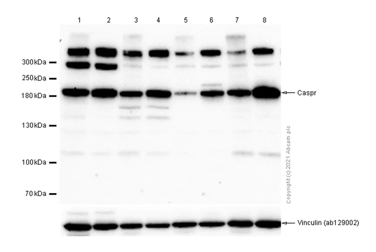 Western blot - Anti-Caspr antibody [EPR7828] (AB133634)