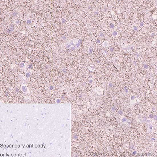 Immunohistochemistry (Formalin/PFA-fixed paraffin-embedded sections) - Anti-Caspr antibody [K65/35] (AB252535)