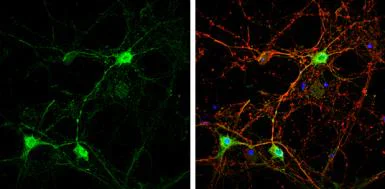 Immunocytochemistry/ Immunofluorescence - Anti-Caspr2/CNTNAP2 antibody (AB153856)