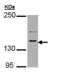 Western blot - Anti-Caspr2/CNTNAP2 antibody (AB153856)