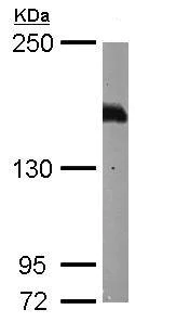 Western blot - Anti-Caspr2/CNTNAP2 antibody (AB153856)
