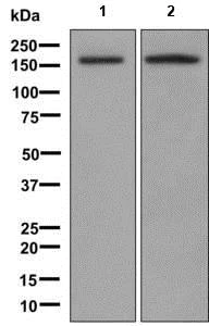 Western blot - Anti-Caspr2/CNTNAP2 antibody [EPR8738] (AB137052)
