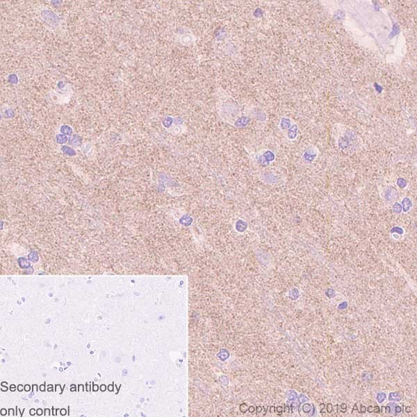 Immunohistochemistry (Formalin/PFA-fixed paraffin-embedded sections) - Anti-Caspr2/CNTNAP2 antibody [K67/25] (AB252534)