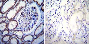 Immunohistochemistry (Formalin/PFA-fixed paraffin-embedded sections) - Anti-CaSR antibody [5C10, ADD] (AB19347)