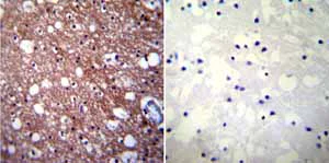 Immunohistochemistry (Formalin/PFA-fixed paraffin-embedded sections) - Anti-CaSR antibody [5C10, ADD] (AB19347)