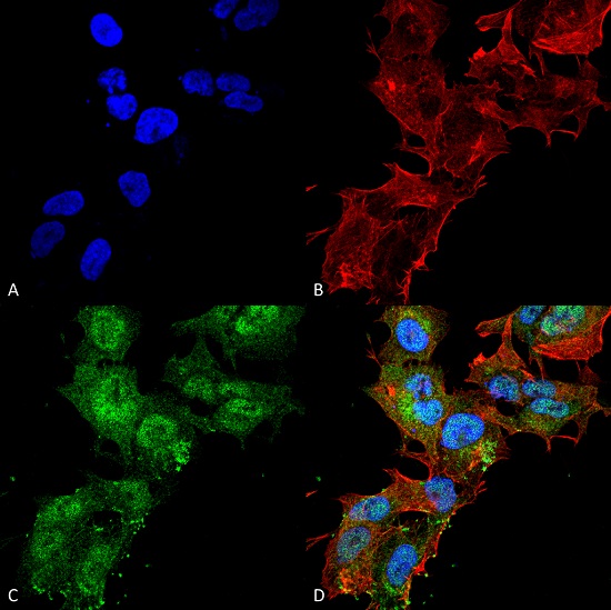 Immunocytochemistry/ Immunofluorescence - Anti-CaSR antibody (AB223360)