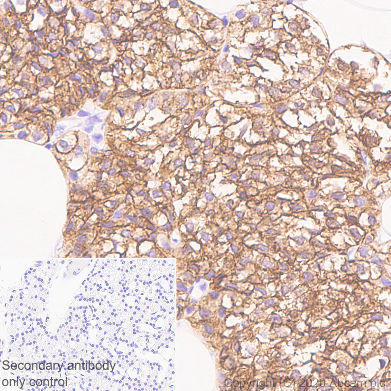 Immunohistochemistry (Formalin/PFA-fixed paraffin-embedded sections) - Anti-CaSR antibody [EPR24050-59] (AB259846)