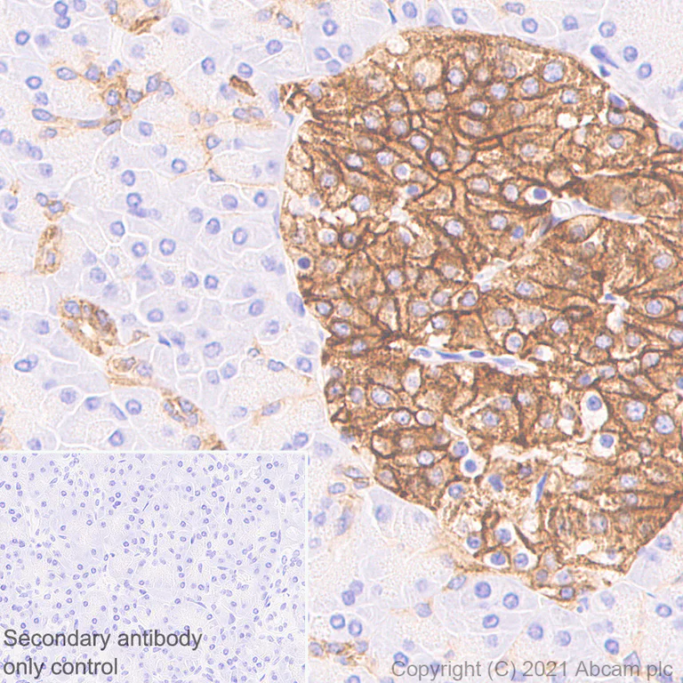 Immunohistochemistry (Formalin/PFA-fixed paraffin-embedded sections) - Anti-CaSR antibody [EPR24050-59] (AB259846)