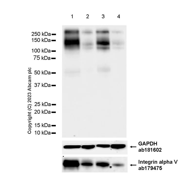 Western blot - Anti-CaSR antibody [EPR24050-59] (AB259846)