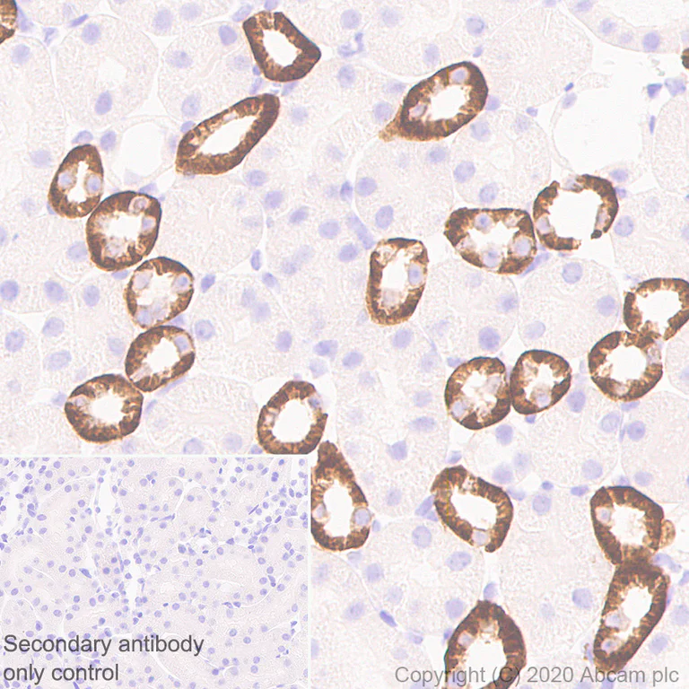 Immunohistochemistry (Formalin/PFA-fixed paraffin-embedded sections) - Anti-CaSR antibody [EPR24050-59] - BSA and Azide free (AB280360)