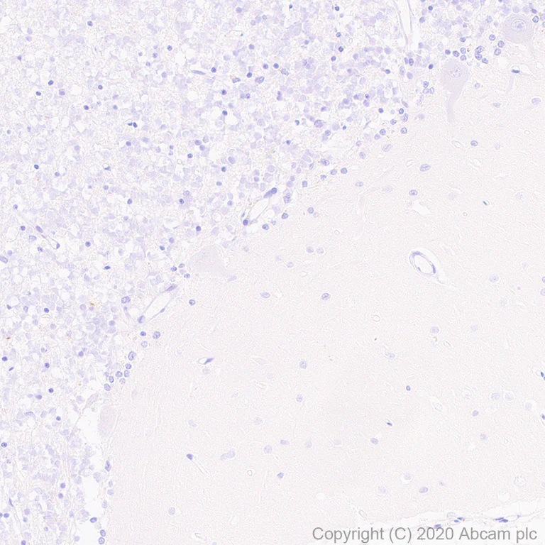 Immunohistochemistry (Formalin/PFA-fixed paraffin-embedded sections) - Anti-CaSR antibody [EPR24050-59] - BSA and Azide free (AB280360)