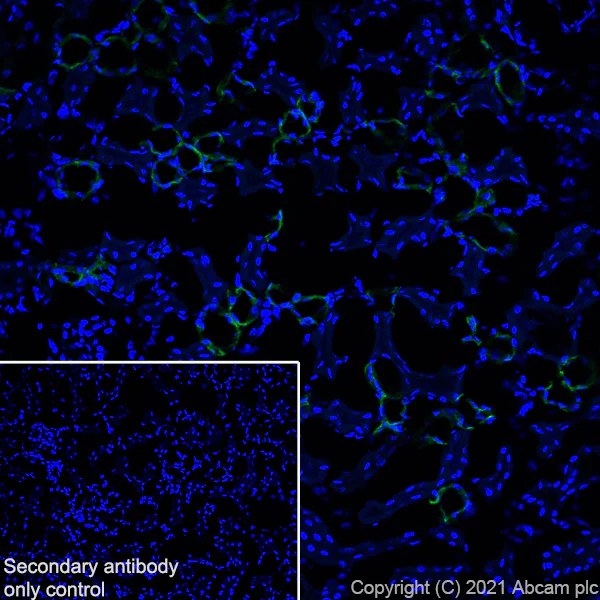 Immunohistochemistry (Frozen sections) - Anti-CaSR antibody [EPR24050-59] - BSA and Azide free (AB280360)