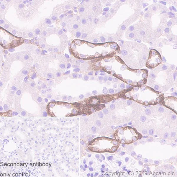 Immunohistochemistry (Formalin/PFA-fixed paraffin-embedded sections) - Anti-CaSR antibody [HL1499] (AB255957)