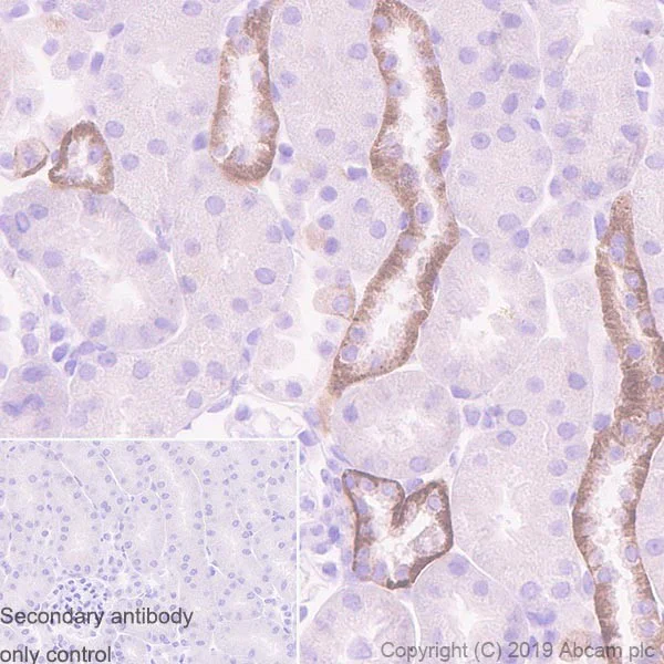 Immunohistochemistry (Formalin/PFA-fixed paraffin-embedded sections) - Anti-CaSR antibody [HL1499] (AB255957)