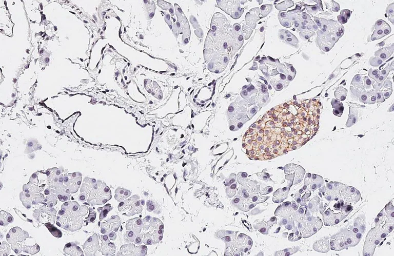 Immunohistochemistry (Formalin/PFA-fixed paraffin-embedded sections) - Anti-CASR antibody [HL2357] - BSA and Azide free (AB325840)
