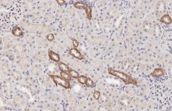 Immunohistochemistry (Formalin/PFA-fixed paraffin-embedded sections) - Anti-CASR antibody [HL2357] - BSA and Azide free (AB325840)