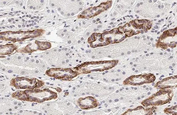Immunohistochemistry (Formalin/PFA-fixed paraffin-embedded sections) - Anti-CASR antibody [HL2357] - BSA and Azide free (AB325840)