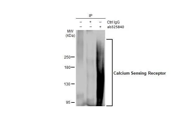 Immunoprecipitation - Anti-CASR antibody [HL2357] - BSA and Azide free (AB325840)