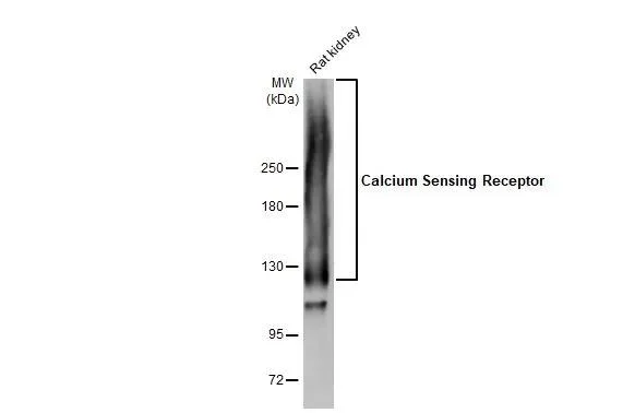 Western blot - Anti-CASR antibody [HL2357] - BSA and Azide free (AB325840)