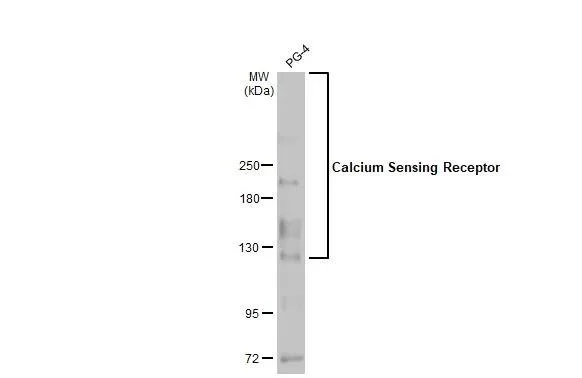 Western blot - Anti-CASR antibody [HL2357] - BSA and Azide free (AB325840)
