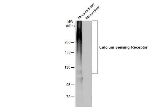 Western blot - Anti-CASR antibody [HL2357] - BSA and Azide free (AB325840)