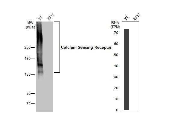 Western blot - Anti-CASR antibody [HL2357] - BSA and Azide free (AB325840)