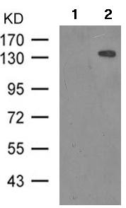 Western blot - Anti-CaSR (phospho T888) antibody (AB182619)