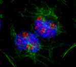 Immunocytochemistry/ Immunofluorescence - Anti-CAST antibody (AB92428)