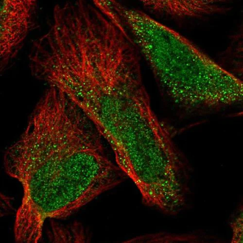 Immunocytochemistry/ Immunofluorescence - Anti-CASZ1 antibody (AB244412)