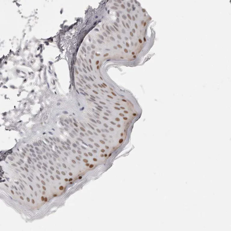 Immunohistochemistry (Formalin/PFA-fixed paraffin-embedded sections) - Anti-CASZ1 antibody (AB244412)