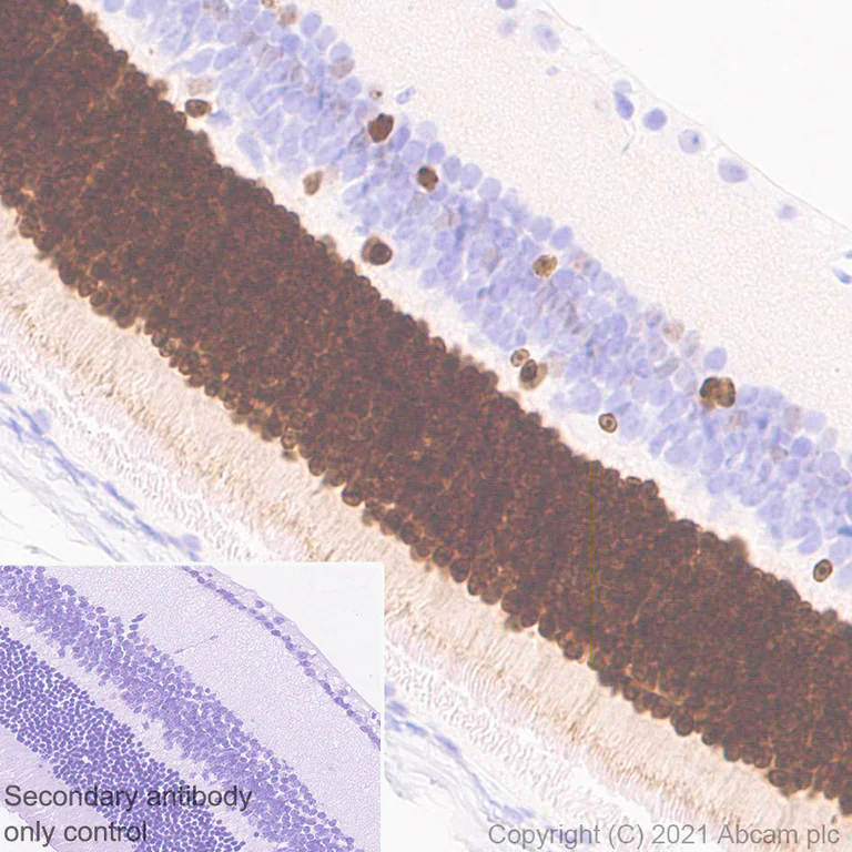 Immunohistochemistry (Formalin/PFA-fixed paraffin-embedded sections) - Anti-CASZ1 antibody [EPR23824-4] - BSA and Azide free (AB283665)