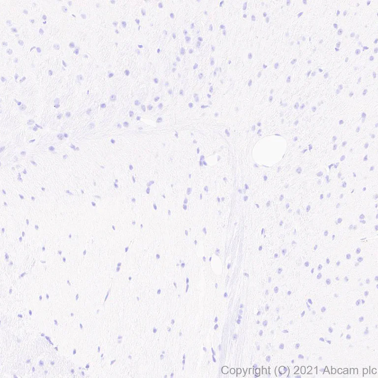 Immunohistochemistry (Formalin/PFA-fixed paraffin-embedded sections) - Anti-CASZ1 antibody [EPR23824-4] - BSA and Azide free (AB283665)