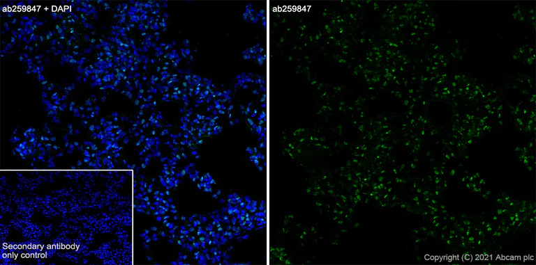 Immunohistochemistry (Frozen sections) - Anti-CASZ1 antibody [EPR23824-4] - BSA and Azide free (AB283665)