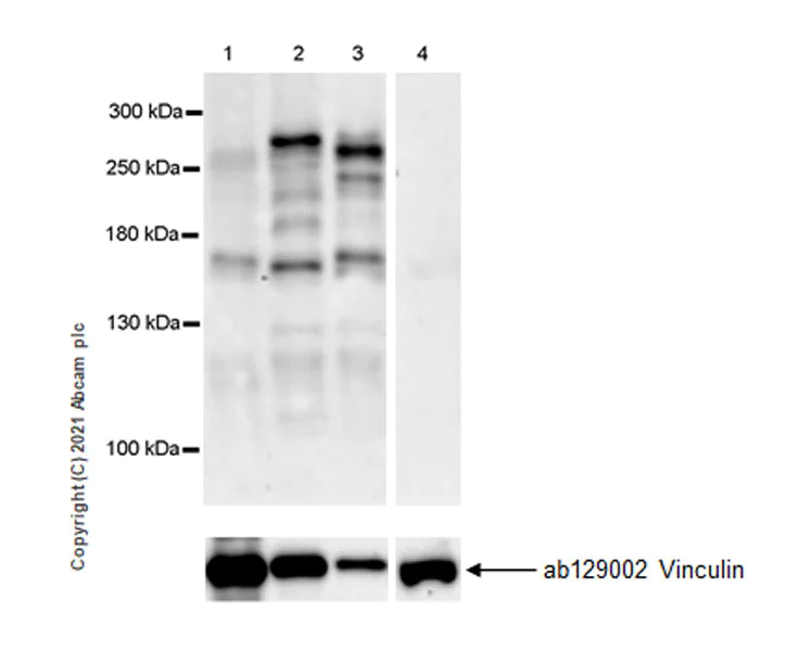 Western blot - Anti-CASZ1 antibody [EPR23824-4] - BSA and Azide free (AB283665)