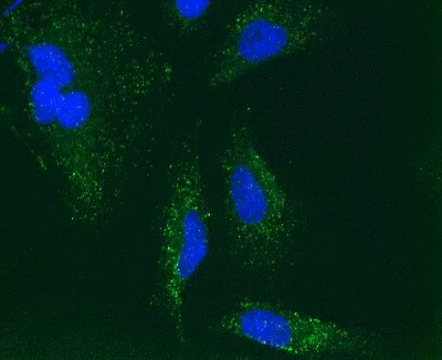 Immunocytochemistry - Anti-Catalase antibody [12C2DB9] - Peroxisome Marker (AB110292)