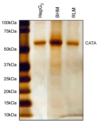 Immunoprecipitation - Anti-Catalase antibody [12C2DB9] - Peroxisome Marker (AB110292)