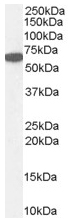 Western blot - Anti-Catalase antibody (AB50434)