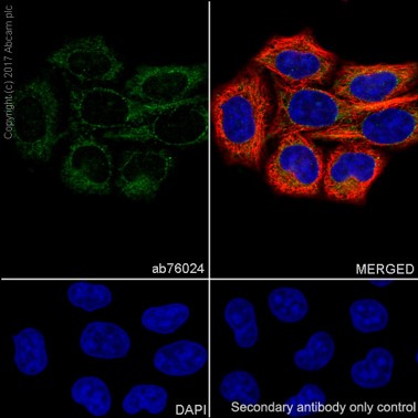 Immunocytochemistry/ Immunofluorescence - Anti-Catalase antibody [EP1929Y] - Peroxisome Marker (AB76024), expandable thumbnail