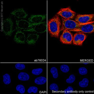 Immunocytochemistry/ Immunofluorescence - Anti-Catalase antibody [EP1929Y] - Peroxisome Marker (AB76024)