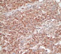 Immunohistochemistry (Formalin/PFA-fixed paraffin-embedded sections) - Anti-Catalase antibody [EP1929Y] - Peroxisome Marker (ab76024), expandable thumbnail