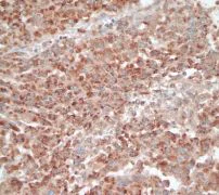 Immunohistochemistry (Formalin/PFA-fixed paraffin-embedded sections) - Anti-Catalase antibody [EP1929Y] - Peroxisome Marker (AB76024)