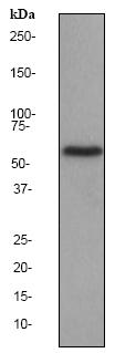 Western blot - Anti-Catalase antibody [EP1929Y] - Peroxisome Marker (AB76024), expandable thumbnail