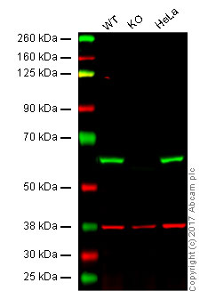 Western blot - Anti-Catalase antibody [EP1929Y] - Peroxisome Marker (AB76024), expandable thumbnail